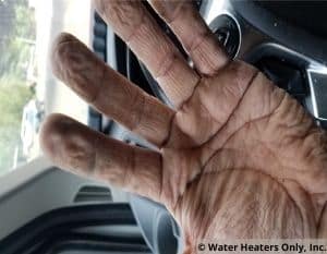 Wrinkly Hand ©